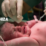 Gastroshiza