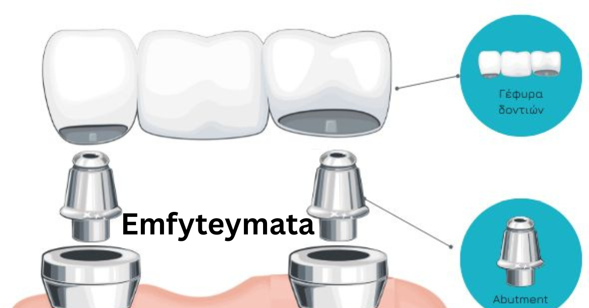 emfyteymata